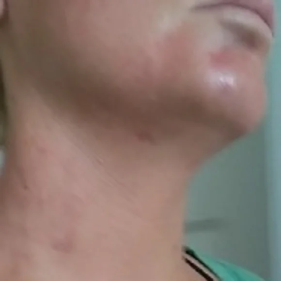 Help - Picture 4 of 4